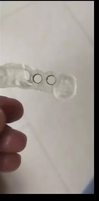 Resin Dental 3D Printer Planti - 3D Printing Dental recension och pris