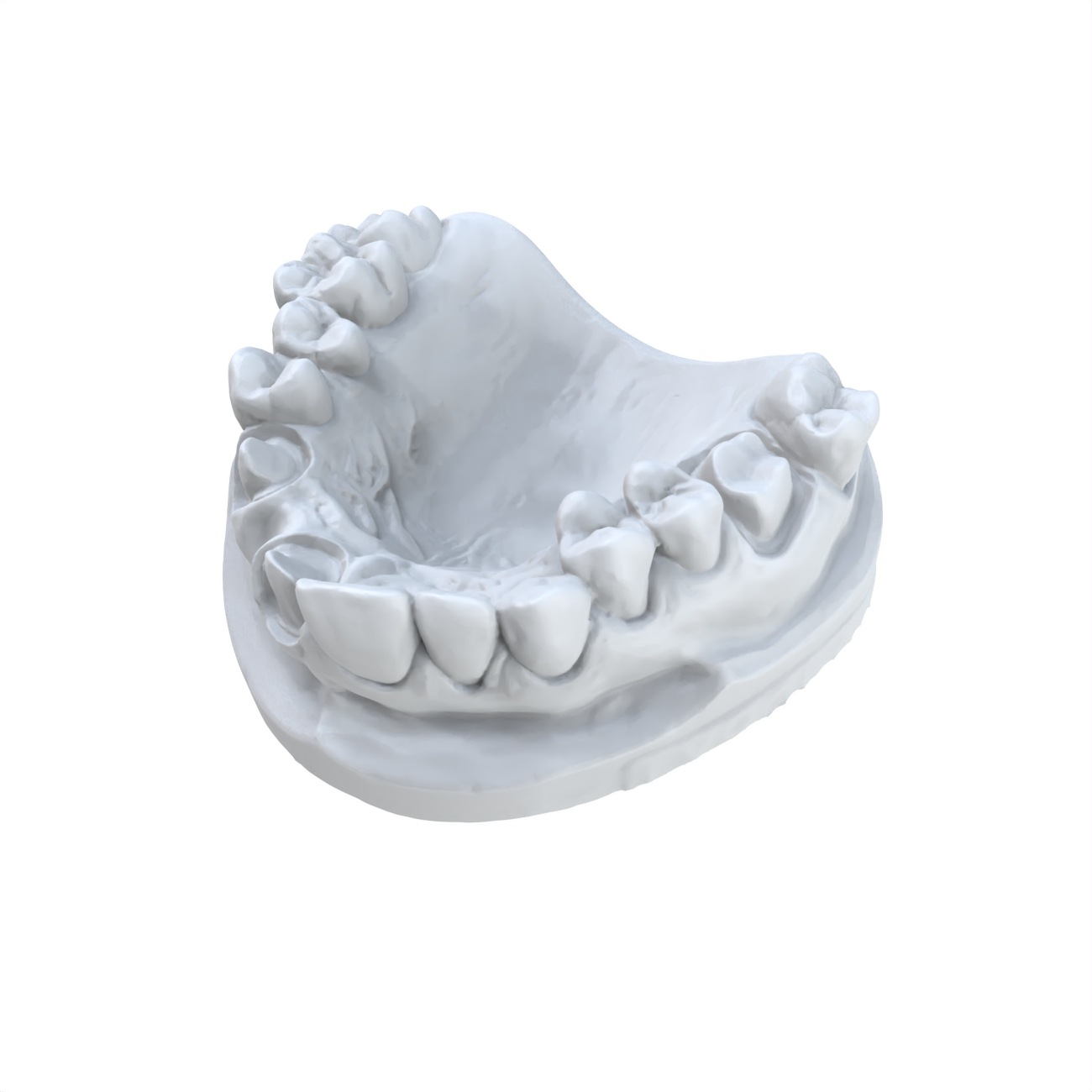 1 PCS Dental Model Preferred 3 - 3D Printing Dental recension och pris