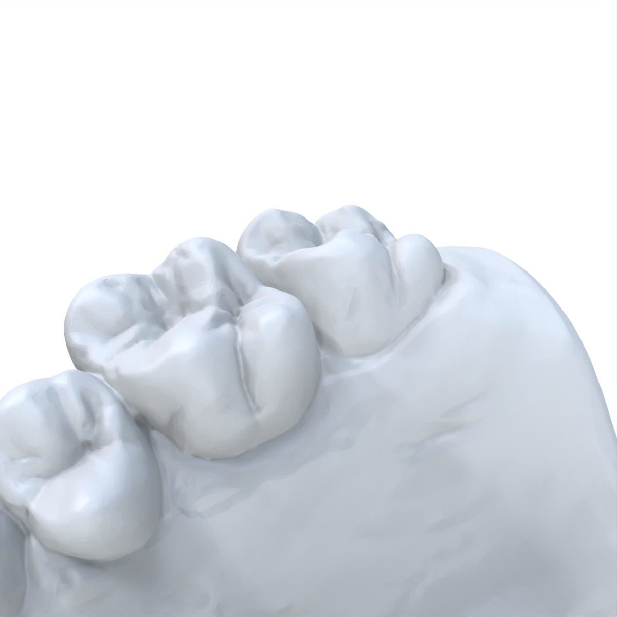 1 PCS Dental Model Preferred 3 - 3D Printing Dental recension och pris