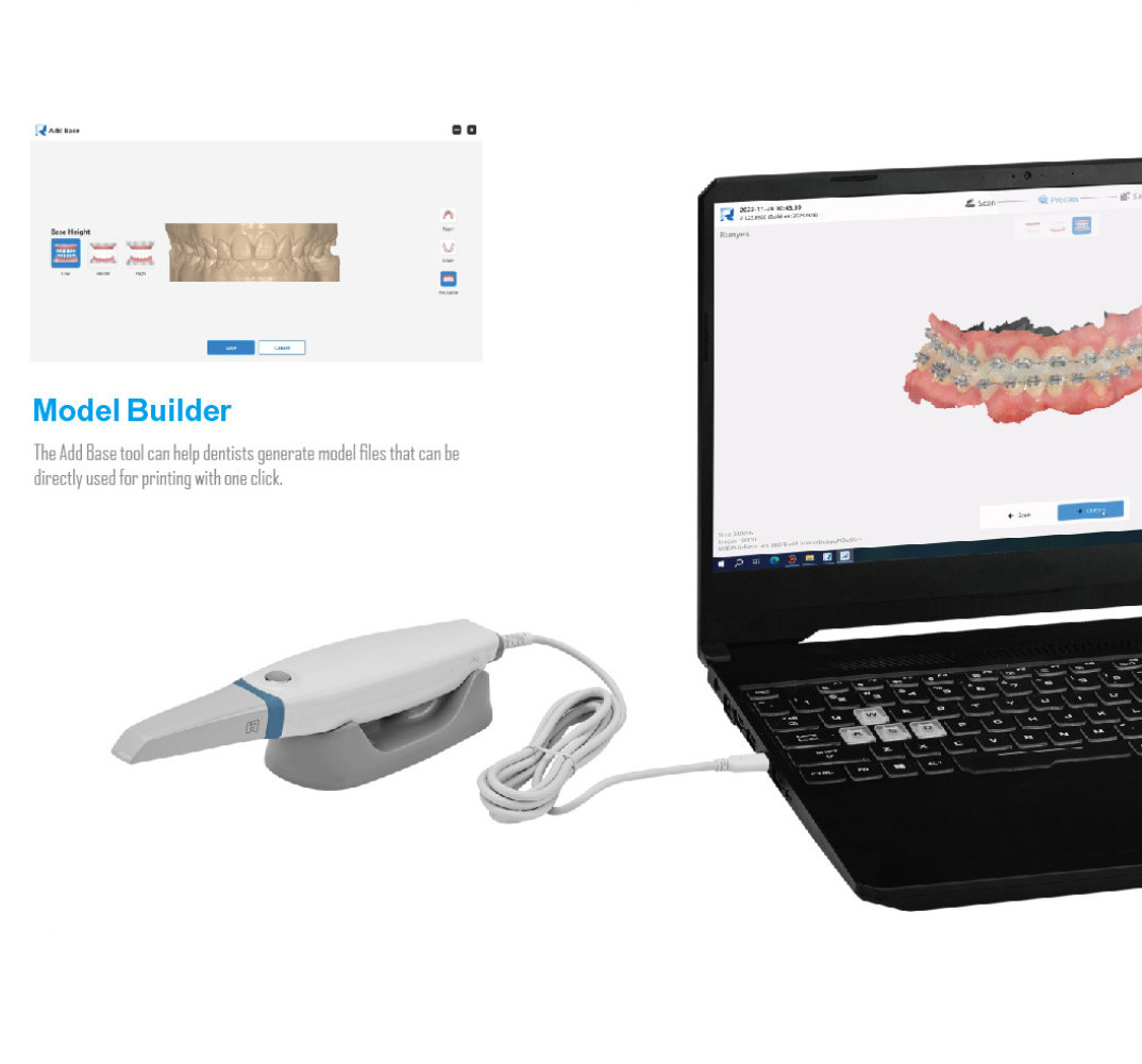 2026 NEW Dental Intraoral Scan - 3D Printing Dental recension och pris